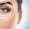 Lasik