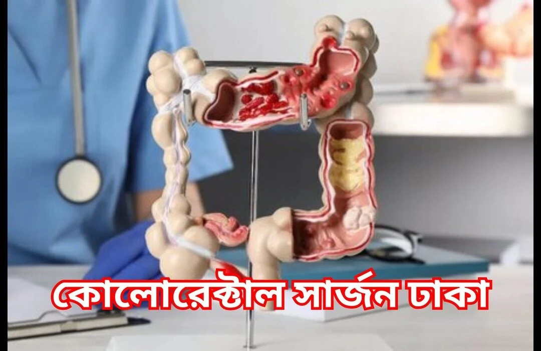 ঢাকার সেরা কোলোরেক্টাল সার্জন এবং চিকিৎসা