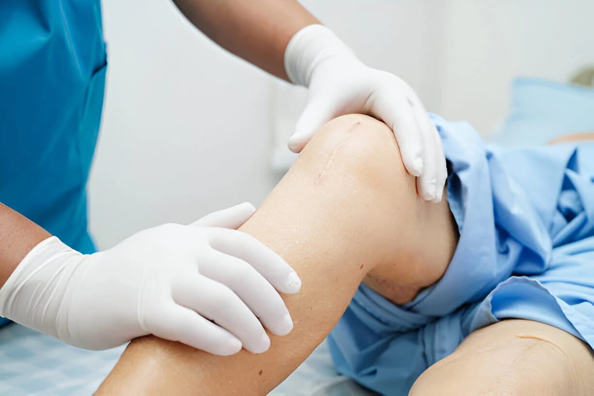 Top Knee Surgery Doctors in Dhaka