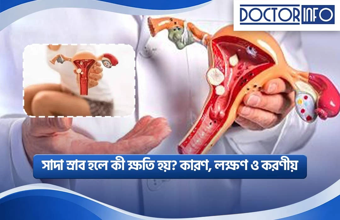 সাদা স্রাব হলে কী ক্ষতি হয়? কারণ, লক্ষণ ও করণীয়