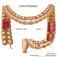 Colorectal Surgeon