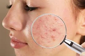 Dermatologist