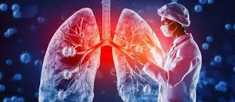 Pulmonologist