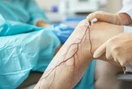 vascular surgeon