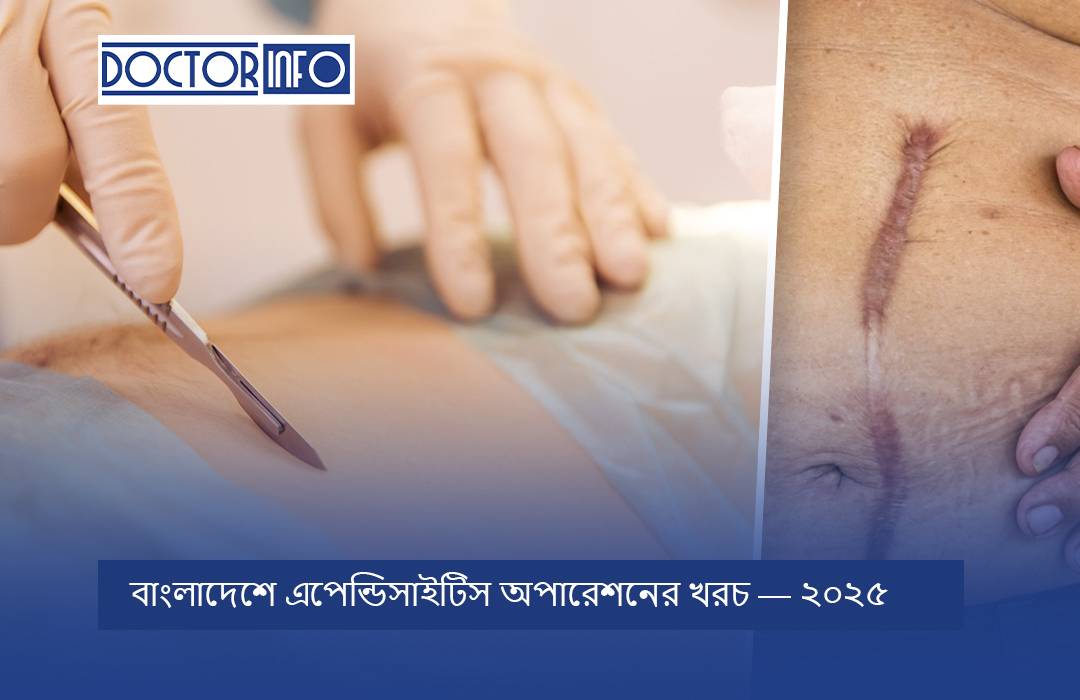 বাংলাদেশে এপেন্ডিসাইটিস অপারেশনের খরচ — ২০২৫
